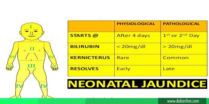 Perbedaan Ikterus Fisiologis Dan Patologis Lengkap Dokterline